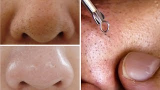 How To Do Facial Clean Up At Home Step By Step For Spotless Clear Skin Rabia Skincare [upl. by Tiana]