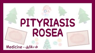 Pityriasis rosea  definition clinical picture diagnosis amp treatment شرح عربي [upl. by Ainirtak]