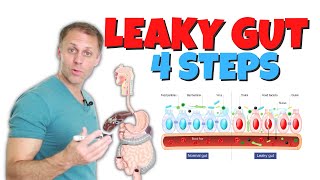 4 Steps to Improve Leaky Gut [upl. by Efar]