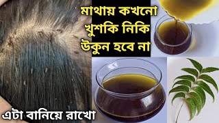 চুলের খুশকি নিকি বা উকুন স্থায়ীভাবে দূর করার সবচেয়ে সহজ উপায়Get Rid of Lice amp NitsDandruff Remove [upl. by Dylan]