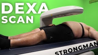 4X WORLDS STRONGEST MAN DEXA SCAN RESULTS [upl. by Jean-Claude]