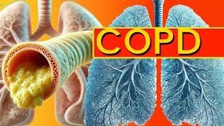 COPD Explained How to Spot Early Symptoms Before Its Too Late [upl. by Neraj]