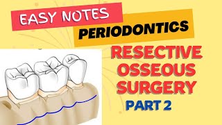 RESECTIVE OSSEOUS SURGERY  PERIODONTICS  Part 2  easy notes [upl. by Rednael831]