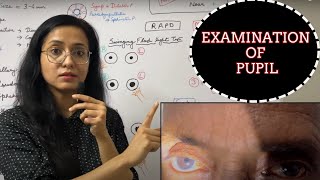 Examination Of Pupil  RAPD  Light Near Dissociation [upl. by Ykciv]