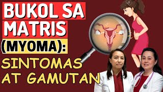 BUKOL sa MATRIS Myoma  Sintomas at Gamutan  By Doc Liza RamosoOng [upl. by Felise]