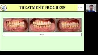 Geriadent 2024 Paper Presentation [upl. by Godric]