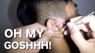 Mans Hard amp Dry Earwax Removal without applying Ear wax Softener [upl. by Ylla]