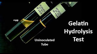 Gelatin Hydrolysis A Biochemical Test for Identification of Gelatinase Enzyme Producing Bacteria [upl. by Francene]