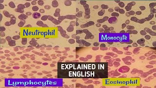 NeutrophilLymphocytemonocyte amp eosinophil actual view under microscopehow to differentiate easily [upl. by Daraj]