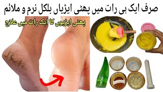 Remove Cracked Heels Remedy  یہ کریم آ پ کو پھر سے جوان بنا دے گیCrack Heel Cream Winter Cream [upl. by Juanne183]