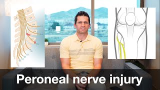 foot drop  L5 Radiculopathy vs Peroneal Nerve Injury [upl. by Nickolaus]