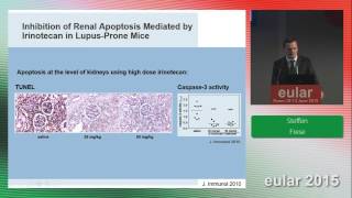 Lupus Nephritis and Irinotecan at EULAR 2015 [upl. by Grissom]