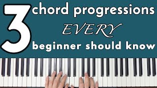 Common Chord Progressions Every Beginner Should Know [upl. by Ress334]