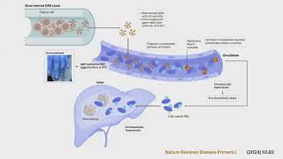 Webinaire AIH  Anémie hémolytique autoimmune [upl. by Ahseka]