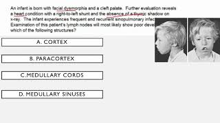 Immunodeficiency Syndromes USMLE Questions [upl. by Aneris714]