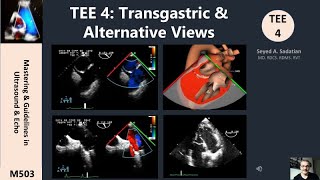 TEE 4 Transgastric amp Alternative Views [upl. by Aihsekan]