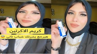 كريم الاكرتين هيرجع بشرتك شباب وصحيه من تاني 👌رخيص بس خطييير 😨beauty skincare explore تجميل [upl. by Galasyn]