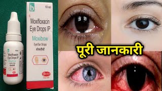 Moxifloxacin eye drops Moxibow eye drops price side effects uses Aankh ka best drops [upl. by Nuncia717]