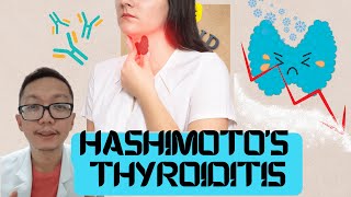 Ano ang Hashimotos thyroiditis   By Doc Mar [upl. by Munster]