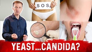 Yeast Infection vs Candida Infection Is there a Difference – DrBerg [upl. by Sarchet]