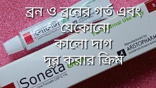 Mukher kalo dag dur korar creamত্বকে Soneta cream এর কাজ কি [upl. by Roxana]