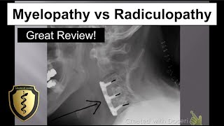 Myelopathy vs Radiculopathy  Great Review [upl. by Nivlak]