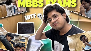 SCARIEST MBBS EXAMS 2nd Year MBBS Exams Medical Exams [upl. by Yl]