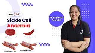 Sickle Cell Anaemia  Pathogenesis  Factors  Diagnosis by DR Priyanka Sachdev  MedLive [upl. by Nasho361]