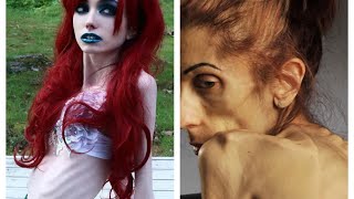 Eugenia Cooney and Rachael Farrokh 💔💔💔 Rachael’s road to recovery [upl. by Henriques]