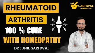 Rheumatoid Arthritis Homeopathy Treatment  Rheumatoid Arthritis Homeopathic Treatment in Hindi [upl. by Mont835]