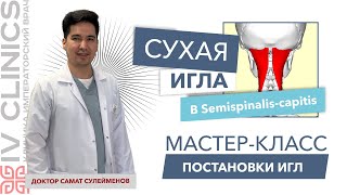 Сухая игла в SEMISPINALIS CAPITIS Полуостистая мышца  Мастеркласс постановки сухой иглы [upl. by Shiff]