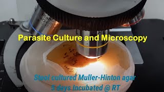 Parasite Culture and Microscopy [upl. by Atirat]