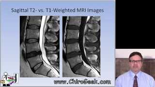 Dr Gillard lectures on How to Read Your Lumbar MRI [upl. by Etteniotnna]