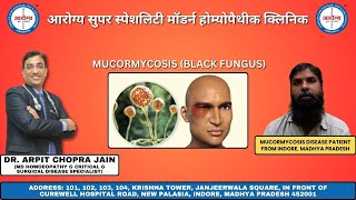 Black Fungus Mucormycosis Patient Treated at Dr Arpit Chopra Jain Modern Homoeopathy [upl. by Marmaduke]