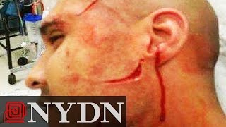 Corrections Officer Slashed in the Face at Rikers Island [upl. by Yrneh]