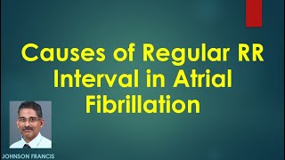 Causes of Regular RR Interval in Atrial Fibrillation [upl. by Marrilee903]