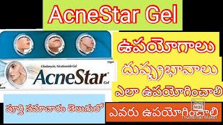 Acnestar gel uses sideeffects in telugubest ointment for pimples in teluguanceacnescardarkspots [upl. by Alma]