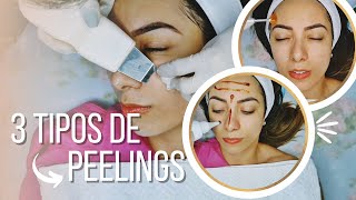 Limpeza de pele personalizada com 3 tipos de peelings na mesma sessão Pele Eudérmica [upl. by Rainah]