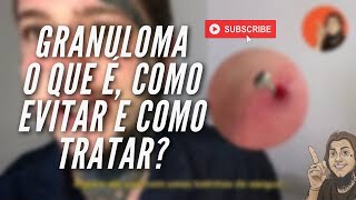 O que é o granuloma do seu piercing como ele surge e como tratar [upl. by Earahc]