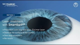 Touchless eye laser treatment SmartSurface  TransPRK with SCHWIND AMARIS laser systems [upl. by Maloy]