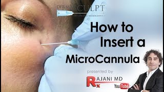 How to Insert the MicroCannulaDermal FillersDr Rajani [upl. by Ignace]