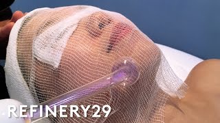 High Frequency Facial For Clear Skin  Beauty With Mi  Refinery29 [upl. by Airdnahs]