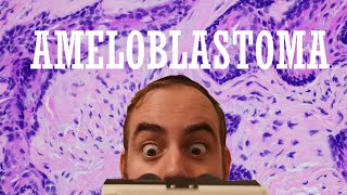 The ULTIMATE Ameloblastoma Review Video [upl. by Okihsoy725]