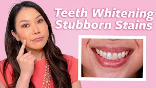 Why Your Teeth Wont Whiten And Solutions for Stubborn Stains  Dr Joyce Kahng [upl. by Nasas822]