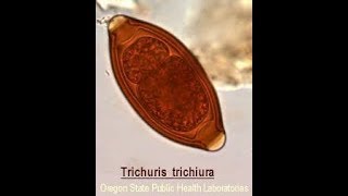 Trichuris trichura or whip worm egg [upl. by Nelehyram]