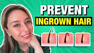 4 Tips amp Tricks to Prevent Ingrown Hair  Dr Shereene Idriss [upl. by Namien88]