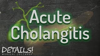 Acute Cholangitis  Tokyo Guidelines 2013  Details [upl. by Dielle]