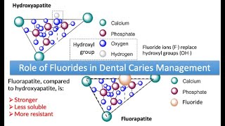 Role of Fluorides in Dental Caries Management [upl. by Kolva]