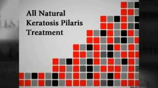 All Natural Keratosis Pilaris Treatment [upl. by Aneer78]