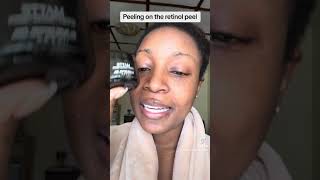 Peeling on the retinol peel how I did it link in comments [upl. by Eilagam]